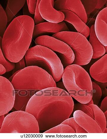 Stock Photo - Human red blood cells, coloured scanning electron micrograph (SEM). Red blood cells (RBCs), or erythrocytes, are the most common type of blood cell in vertebrates. They are involved in delivering oxygen to the body tissue. RBCs take up oxygen in the.... Fotosearch