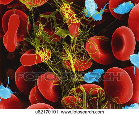 Stock Image - Human red blood cells trapped in a fibrin blood clot, coloured scanning electron micrograph (SEM). Platelets in the blood are small oval disks and are termed nonactivated platelets or thrombocytes. Platelets serve as the body's first line of defence.... Fotosearch