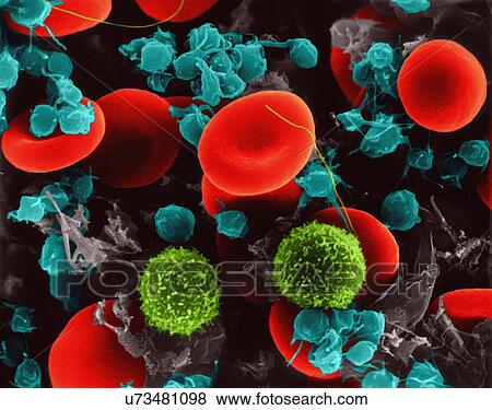 Stock Photo - Human red blood cells, two T lymphocytes and platelets, coloured scanning electron micrograph (SEM). Red blood cells (RBCs), or erythrocytes, are the most common type of blood cell in vertebrates. They are involved in delivering oxygen to the body.... Fotosearch
