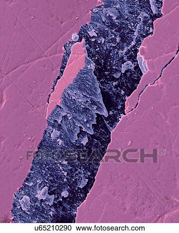 Stock Image - Human tooth fractured enamel, coloured scanning electron micrograph (SEM). Fracture in a tooth revealing the enamel rod morphology. Tooth enamel is the highly mineralized covering of the crown of a tooth. It is the hardest and most highly mineralized.... Fotosearch