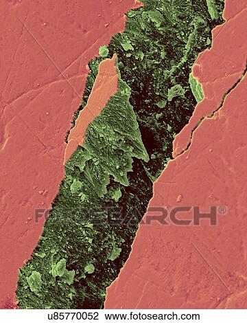 Stock Image - Human tooth fractured enamel, coloured scanning electron micrograph (SEM). Fracture in a tooth revealing the enamel rod morphology. Tooth enamel is the highly mineralized covering of the crown of a tooth. It is the hardest and most highly mineralized.... Fotosearch