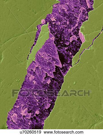 Stock Photo - Human tooth fractured enamel, coloured scanning electron micrograph (SEM). Fracture in a tooth revealing the enamel rod morphology. Tooth enamel is the highly mineralized covering of the crown of a tooth. It is the hardest and most highly mineralized.... Fotosearch