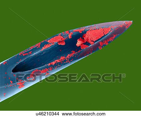 Picture - Hypodermic needle (26 gauge) and human blood, coloured scanning electron micrograph (SEM). Red blood cells (RBCs), or erythrocytes, are the most common type of blood cell in vertebrates. They are involved in delivering oxygen to the body tissue. RBCs.... Fotosearch