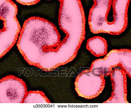 Influenza A virus (RNA virus, Orthomyxoviridae Family), coloured transmission electron micrograph (TEM). 'Influenza Virus', often know as 'The Flu Virus' often changes or mutates, complicating the development of suitable vaccines for all strains. As a... View Large Photo Image Stock Image - Influenza A virus (RNA virus, Orthomyxoviridae Family), coloured transmission electron micrograph (TEM). 'Influenza Virus', often know as 'The Flu Virus' often changes or mutates, complicating the development of suitable vaccines for all strains. As a.... Fotosearch