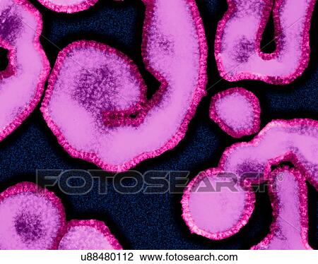 Stock Image - Influenza A virus (RNA virus, Orthomyxoviridae Family), coloured transmission electron micrograph (TEM). 'Influenza Virus', often know as 'The Flu Virus' often changes or mutates, complicating the development of suitable vaccines for all strains. As a.... Fotosearch
