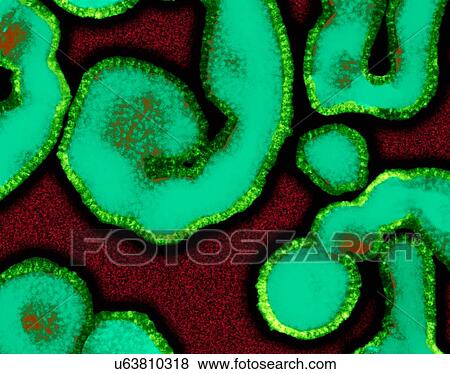 Stock Photo - Influenza A virus (RNA virus, Orthomyxoviridae Family), coloured transmission electron micrograph (TEM). 'Influenza Virus', often know as 'The Flu Virus' often changes or mutates, complicating the development of suitable vaccines for all strains. As a.... Fotosearch