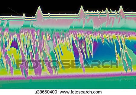 Stock Image - Light micrograph (LM) of Vitamin A crystals. Vitamin A (retinol or retinoic acid) is a fat-soluble (lipophilic) vitamin essential for the synthesis of pigments in the eye. It aids new cell growth and skin health. It also appears to reduce the risk of.... Fotosearch