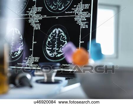 Picture - Magnetic resonance imaging (MRI) brain scans displayed on a screen on a doctor's desk.. Fotosearch