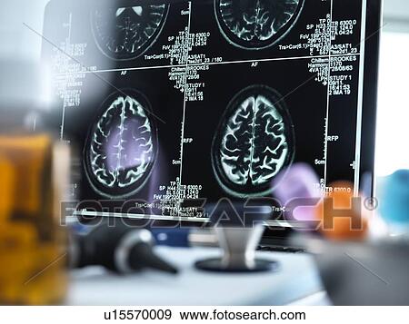 Stock Photo - Magnetic resonance imaging (MRI) brain scans displayed on a screen on a doctor's desk.. Fotosearch