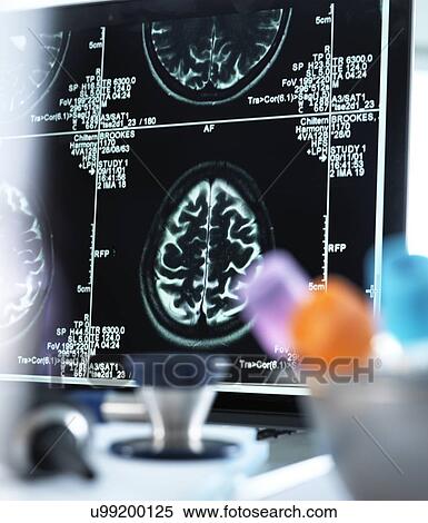 Stock Photography - Magnetic resonance imaging (MRI) brain scans displayed on a screen on a doctor's desk.. Fotosearch