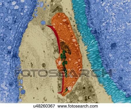 Protozoan infection (giardiasis) in human intestinal lumen (Giardia sp. ), coloured transmission electron micrograph (TEM). Vegetative phase called trophozoite that develops from a cyst infection in the small intestine. Giardia lamblia, a human... View Large Photo Image Stock Photo - Protozoan infection (giardiasis) in human intestinal lumen (Giardia sp. ), coloured transmission electron micrograph (TEM). Vegetative phase called trophozoite that develops from a cyst infection in the small intestine. Giardia lamblia, a human.... Fotosearch