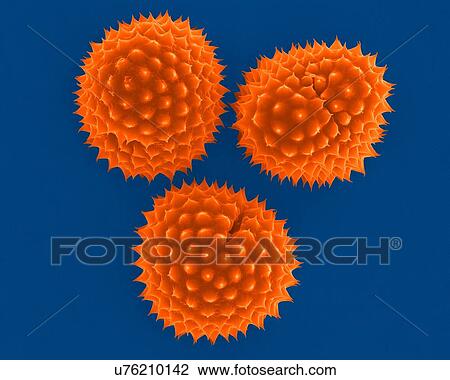 Stock Image - Ragweed (Ambrosia psilostachya) pollen, coloured scanning electron micrograph (SEM). This pollen is an allergen. Ragweed is a main cause of weed allergies. Ragweed pollen is notorious for causing allergic reactions in humans, specifically allergic.... Fotosearch