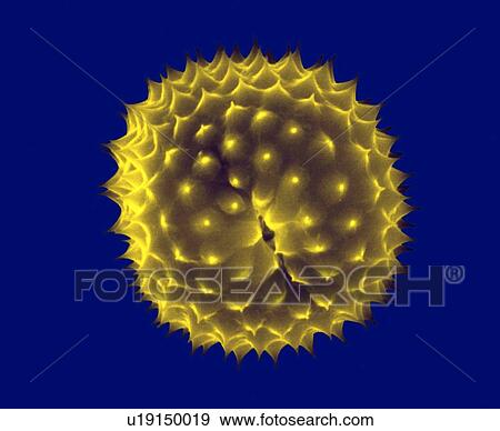 Stock Photo - Ragweed pollen, Ambrosia psilostachya, coloured scanning electron micrograph (SEM). This pollen is an allergen. Ragweed is a main cause of weed allergies. Ragweed pollen is notorious for causing allergic reactions in humans, specifically allergic.... Fotosearch