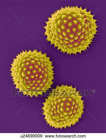 Stock Photo - Ragweed pollen (Ambrosia psilostachya), coloured scanning electron micrograph (SEM). This pollen is an allergen. Ragweed is a main cause of weed allergies. Ragweed pollen is notorious for causing allergic reactions in humans, specifically allergic.... Fotosearch