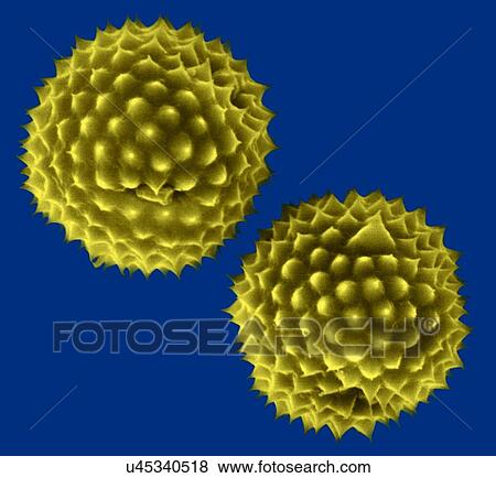Stock Photo - Ragweed pollen, Ambrosia psilostachya, coloured scanning electron micrograph (SEM). This pollen is an allergen. Ragweed is a main cause of weed allergies. Ragweed pollen is notorious for causing allergic reactions in humans, specifically allergic.... Fotosearch