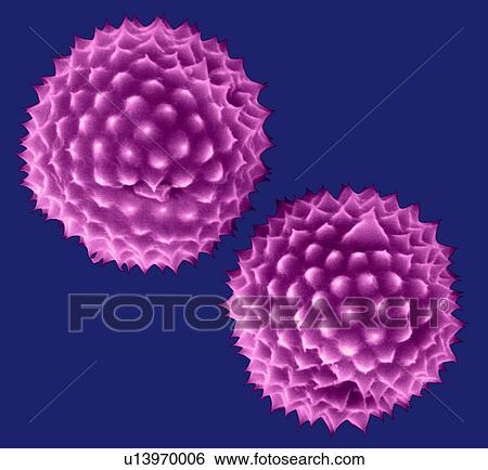 Stock Photograph - Ragweed pollen -Ambrosia psilostachya, coloured scanning electron micrograph (SEM). This pollen is an allergen. Ragweed is a main cause of weed allergies. Ragweed pollen is notorious for causing allergic reactions in humans, specifically allergic.... Fotosearch