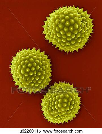 Ragweed pollen (Ambrosia psilostachya), coloured scanning electron micrograph (SEM). This pollen is an allergen. Ragweed is a main cause of weed allergies. Ragweed pollen is notorious for causing allergic reactions in humans, specifically allergic... View Large Photo Image Stock Photography - Ragweed pollen (Ambrosia psilostachya), coloured scanning electron micrograph (SEM). This pollen is an allergen. Ragweed is a main cause of weed allergies. Ragweed pollen is notorious for causing allergic reactions in humans, specifically allergic.... Fotosearch