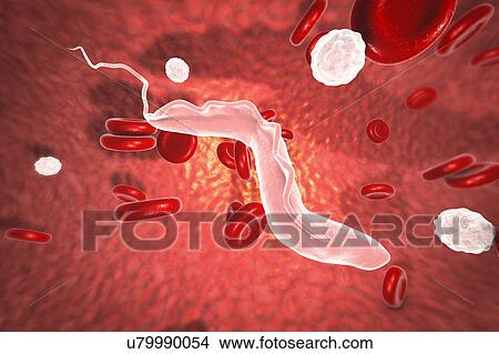 Picture - Sleeping sickness. Computer illustration of a trypanosome (Trypanosoma brucei) moving past human red blood cells in the blood. This protozoan is the cause of sleeping sickness (African trypanosomiasis). It is a vector-borne parasite transmitted by.... Fotosearch