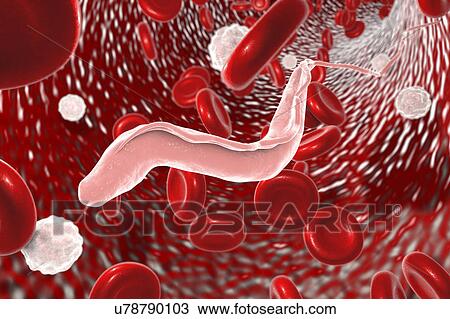 Sleeping sickness. Computer illustration of a trypanosome (Trypanosoma brucei) moving past human red blood cells in the blood. This protozoan is the cause of sleeping sickness (African trypanosomiasis). It is a vector-borne parasite transmitted by... View Large Photo Image Stock Image - Sleeping sickness. Computer illustration of a trypanosome (Trypanosoma brucei) moving past human red blood cells in the blood. This protozoan is the cause of sleeping sickness (African trypanosomiasis). It is a vector-borne parasite transmitted by.... Fotosearch