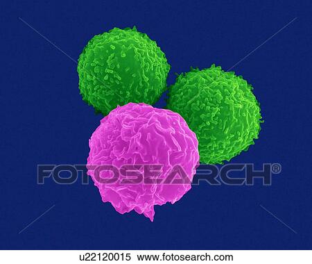 T lymphocytes (pre-T cells) and granulocyte (neutrophil), coloured scanning electron micrograph (SEM). Lymphocytes are involved in the specific immune response and are composed mainly of precursor T cells (pre-T cells) and B cells. Pre-T cells and B... View Large Photo Image Stock Photography - T lymphocytes (pre-T cells) and granulocyte (neutrophil), coloured scanning electron micrograph (SEM). Lymphocytes are involved in the specific immune response and are composed mainly of precursor T cells (pre-T cells) and B cells. Pre-T cells and B.... Fotosearch