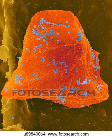 Picture - Used wax dental floss with cheek cells (orange) and bacteria (blue) on dental floss fibres (brown), coloured scanning electron micrograph (SEM). Cheek cells often get scraped from the inside of your mouth when flossing your teeth. Numerous bacteria.... Fotosearch