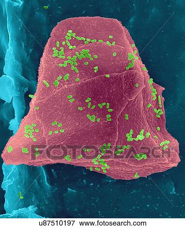 Stock Photo - Used wax dental floss with cheek cells (purple) and bacteria (green) on dental floss fibres (blue), coloured scanning electron micrograph (SEM). Cheek cells often get scraped from the inside of your mouth when flossing your teeth. Numerous bacteria.... Fotosearch