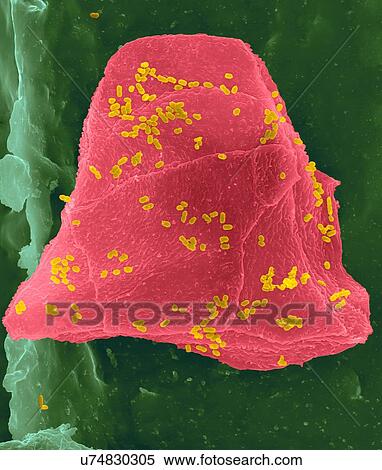 Used wax dental floss with cheek cells (pink) and bacteria (yellow) on dental floss fibres (green), coloured scanning electron micrograph (SEM). Cheek cells often get scraped from the inside of your mouth when flossing your teeth. Numerous bacteria... View Large Photo Image Stock Photography - Used wax dental floss with cheek cells (pink) and bacteria (yellow) on dental floss fibres (green), coloured scanning electron micrograph (SEM). Cheek cells often get scraped from the inside of your mouth when flossing your teeth. Numerous bacteria.... Fotosearch