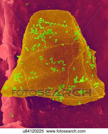Stock Photography - Used wax dental floss with cheek cells (yellow) and bacteria (green) on dental floss fibres (pink), coloured scanning electron micrograph (SEM). Cheek cells often get scraped from the inside of your mouth when flossing your teeth. Numerous bacteria.... Fotosearch