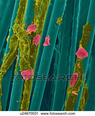 Used wax dental floss with dental plaque (yellow), bacteria (orange) and cheek cells (pink) on the dental floss fibres (blue), coloured scanning electron micrograph (SEM). Plaque consists of a biofilm of bacteria embedded in a glycoprotein matrix. The... View Large Photo Image Stock Image - Used wax dental floss with dental plaque (yellow), bacteria (orange) and cheek cells (pink) on the dental floss fibres (blue), coloured scanning electron micrograph (SEM). Plaque consists of a biofilm of bacteria embedded in a glycoprotein matrix. The.... Fotosearch