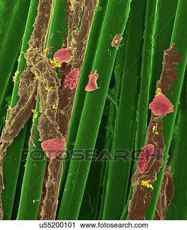 Stock Image - Used wax dental floss with dental plaque (brown), bacteria (yellow) and cheek cells (purple) on the dental floss fibres (green), coloured scanning electron micrograph (SEM). Plaque consists of a biofilm of bacteria embedded in a glycoprotein matrix..... Fotosearch