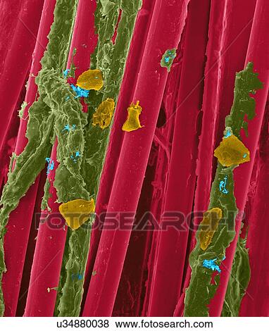 Stock Photo - Used wax dental floss with dental plaque (brown), bacteria (blue) and cheek cells (orange) on the dental floss fibres (red), coloured scanning electron micrograph (SEM). Plaque consists of a biofilm of bacteria embedded in a glycoprotein matrix. The.... Fotosearch