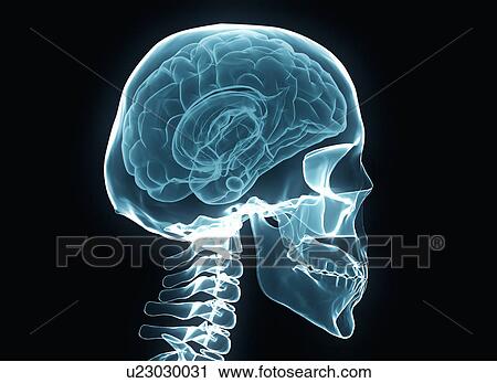 X-ray of the human brain and skull. View Large Photo Image Stock Image - X-ray of the human brain and skull.. Fotosearch
