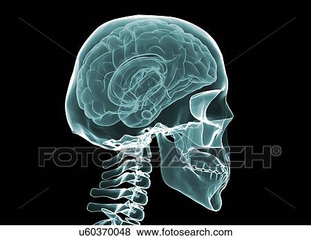 Stock Photo - X-ray of the human brain and skull.. Fotosearch