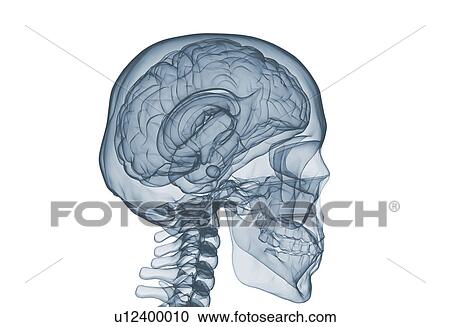 Stock Image - Brain and skull x ray image isolated on white . Fotosearch