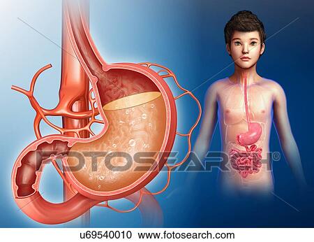 Stock Image - Child with stomach acidity, illustration. Fotosearch