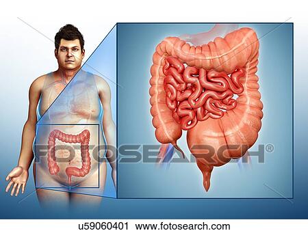 Man with mega colon, illustration View Large Photo Image Stock Image - Man with mega colon, illustration. Fotosearch