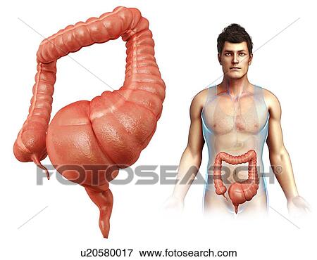 Man with mega colon, illustration View Large Photo Image Stock Photo - Man with mega colon, illustration. Fotosearch