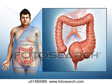 Stock Photography - Man with mega colon, illustration. Fotosearch