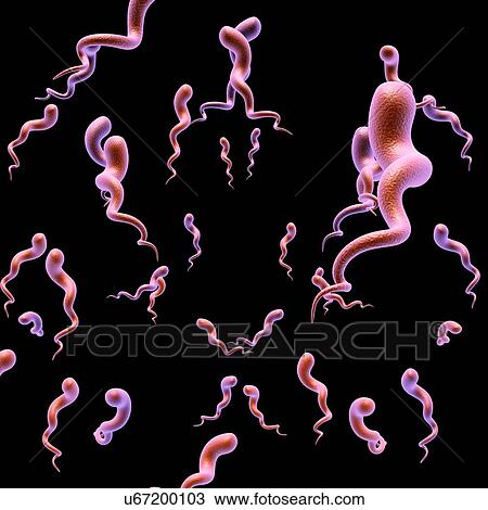 Stock Image - Syphilis bacteria, illustration. Fotosearch