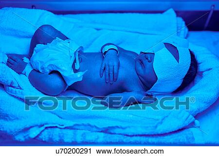 Blue light treatment for baby with jaundice View Large Photo Image Stock Image - Blue light treatment for baby with jaundice. Fotosearch