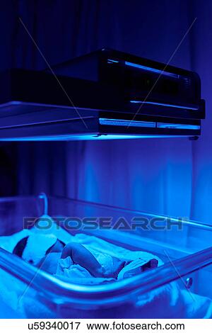 Stock Photo - Blue light treatment for baby with jaundice. Fotosearch