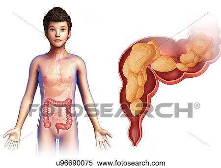 Stock Photography - Child's rectum, illustration. Fotosearch
