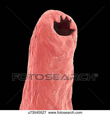 Hookworm head, illustration View Large Photo Image Stock Photo - Hookworm head, illustration. Fotosearch