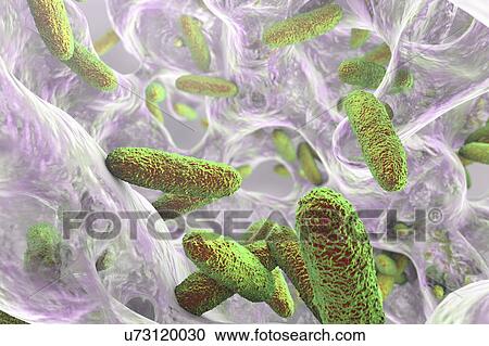 Klebsiella pneumoniae bacteria, illustration View Large Photo Image Stock Image - Klebsiella pneumoniae bacteria, illustration. Fotosearch