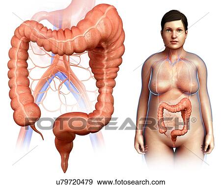 Mega colon, illustration View Large Photo Image Stock Photo - Mega colon, illustration. Fotosearch