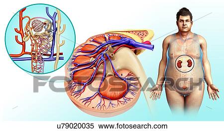 Stock Photography - Obese man's kidney, illustration. Fotosearch