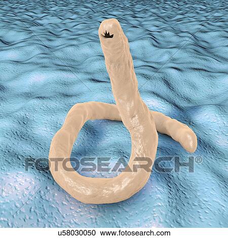 Computer illustration of the parasitic hookworm Ancylostoma duodenale. This is one of the commonest causes of hookworm infestation in humans, particularly in sub-tropical regions such as North Africa and India. The worm's head contains several... View Large Photo Image Stock Image - Computer illustration of the parasitic hookworm Ancylostoma duodenale. This is one of the commonest causes of hookworm infestation in humans, particularly in sub-tropical regions such as North Africa and India. The worm's head contains several.... Fotosearch