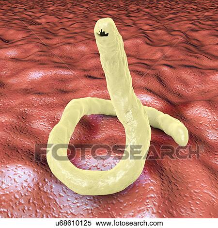 Stock Photography - Computer illustration of the parasitic hookworm Ancylostoma duodenale. This is one of the commonest causes of hookworm infestation in humans, particularly in sub-tropical regions such as North Africa and India. The worm's head contains several.... Fotosearch