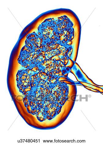 Stock Image - Kidney, CT scan. False colour 3-D computed tomography (CT) scan of a kidney in frontal view.. Fotosearch