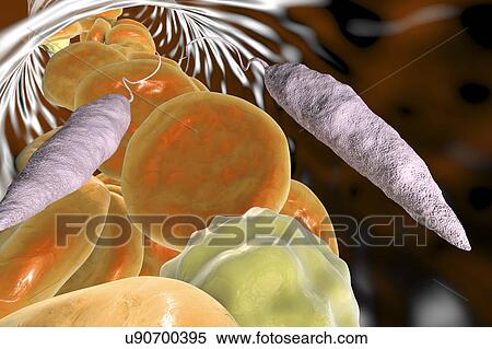 Stock Photography - Leishmania sp. protozoa in blood, computer illustration. This parasite causes the tropical disease leishmaniasis. This can take several forms, causing open sores on the skin or potentially fatal liver damage. It is transmitted by the bites of infected.... Fotosearch